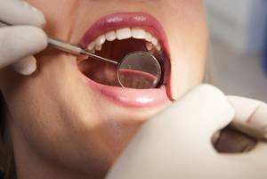 Zahnfleischentzündung, Zahnarztpraxis Lohmen Dr. Haupt